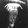 Петрозаводская медуза
